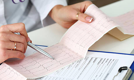 Electrocardiogram