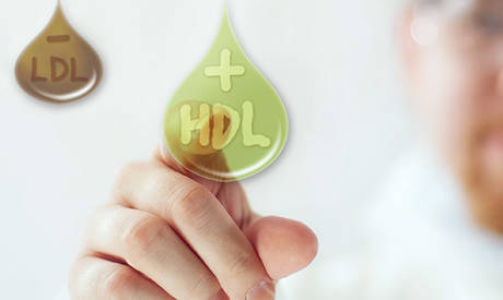 Lipid/Cholesterol Management