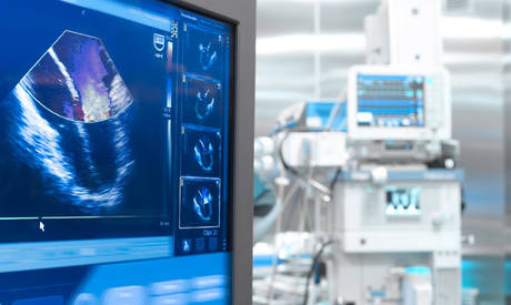 Echocardiography